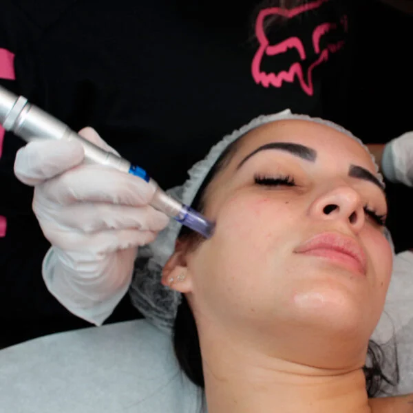 Facial + Dermapen